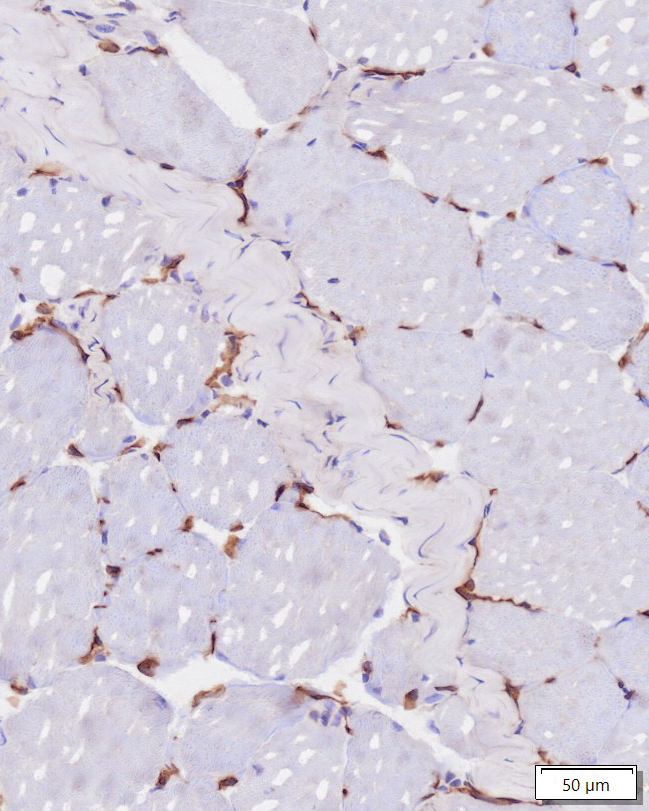 Mouse Frozen Skeletal Muscle_CD31_narrow-1